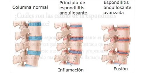 Los dolores en la espalda son de principal atención